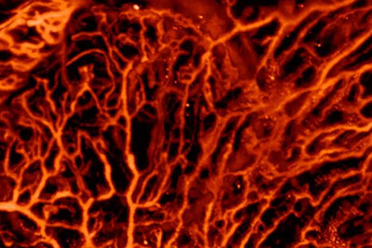 Photo: Lichtwirbel, Anti-Laser und leuchtende Moleküle