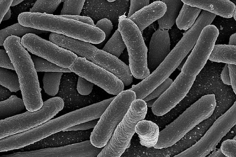 Abb.: Elektronenmikroskopische Aufnahme von Escherichia coli-Bakterien.(Bild:...