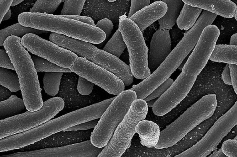 Abb.: Elektronenmikroskopische Aufnahme von Escherichia coli-Bakterien.(Bild:...