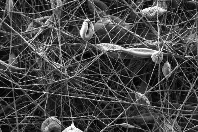 Abb.: Nanofasern, herge­stellt durch Elektro­spinning, unter dem...