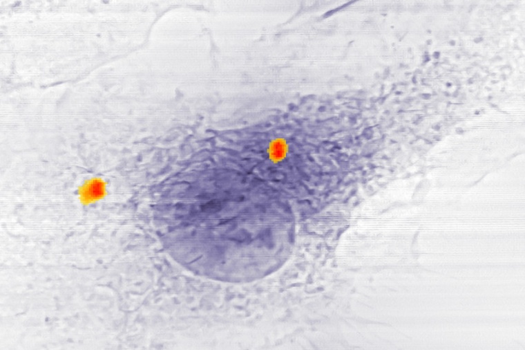 Abb.: Zwei Ansamm­lungen von Anti­biotika-beladenen Eisen-Nano­containern in...