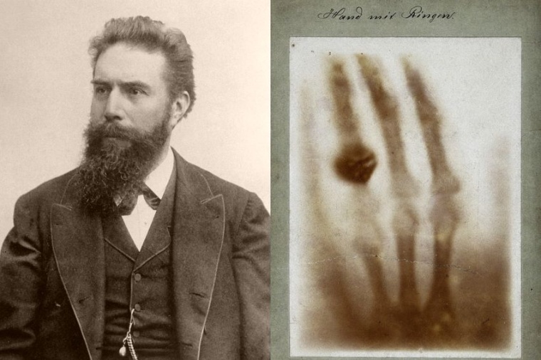 Wilhelm Conrad Röntgen (hier um 1900) nahm kurz nach der Entdeckung der...