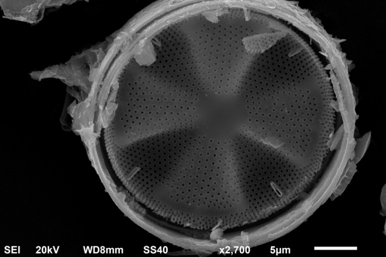 Abb.: Mikroskopische Aufnahme einer Kiesel­alge aus dem NanoSchoolLab (Bild:...